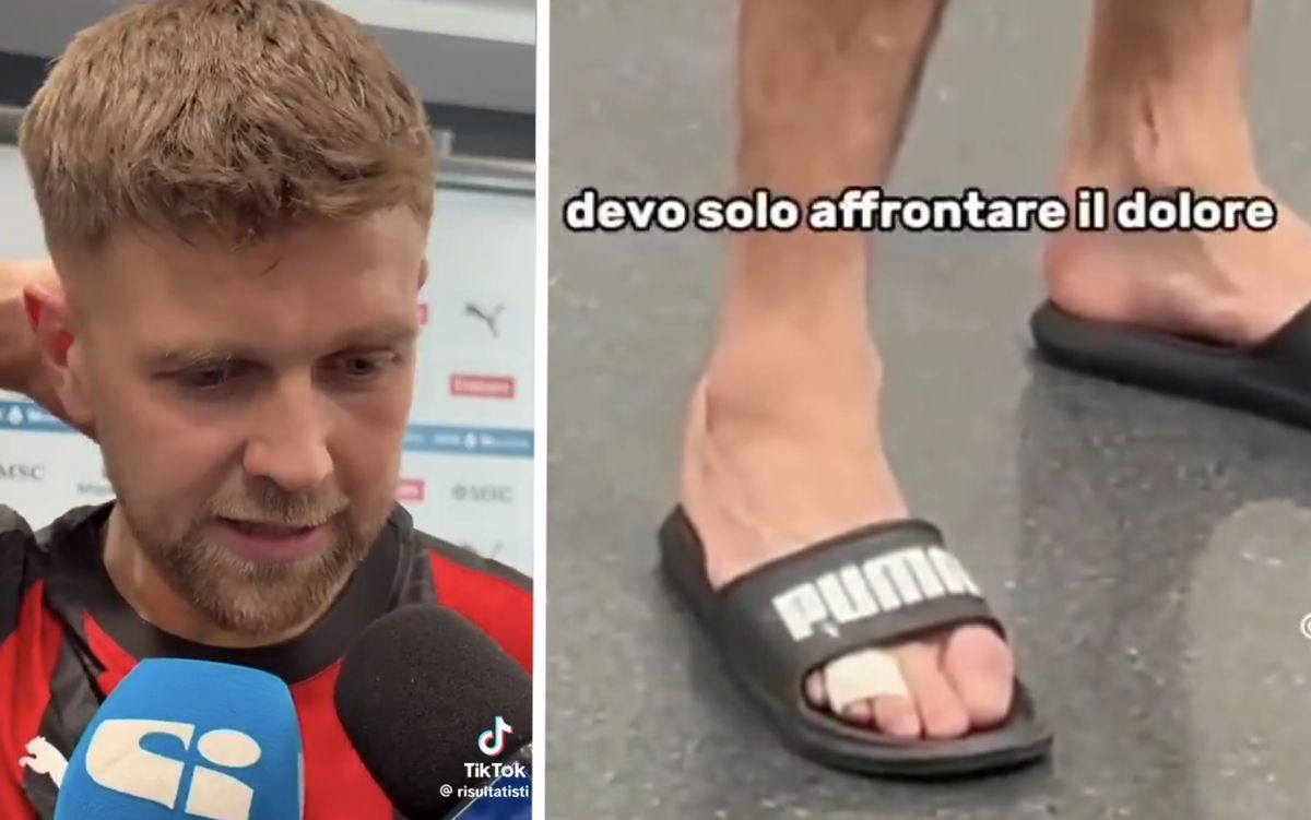 Füllkrug jokes with reporter after being asked about toe injury: “There’s no mystery!”