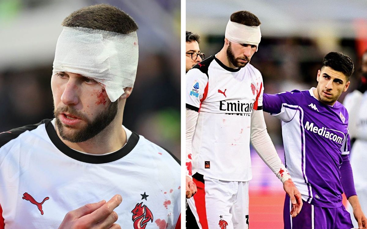 GdS: Nine stitches but a sigh of relief – Pavlovic travels back separately after head scans